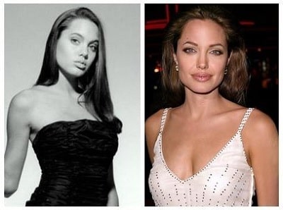 A picture of Angelina Jolie before (left) and after (right).